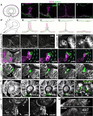 Cell Behaviors during Closure of the Choroid Fissure in the Developing Eye